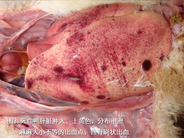 死亡鴨肝臟腫大、土黃色，分布密密麻麻大小不等的出血點，且有刷狀出血